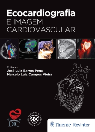 Cover image: Ecocardiografia e Imagem Cardiovascular 1st edition 9786555720006