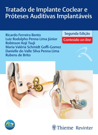 Omslagafbeelding: Tratado de Implante Coclear e Próteses Auditivas Implantáveis 2nd edition 9786555720846