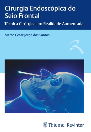 Cover image: Cirurgia Endoscópica do Seio Frontal 1st edition 9786555720877