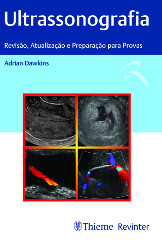 Imagen de portada: Ultrassonografia: Revisão, Atualização e Preparação para Provas 1st edition 9786555721553