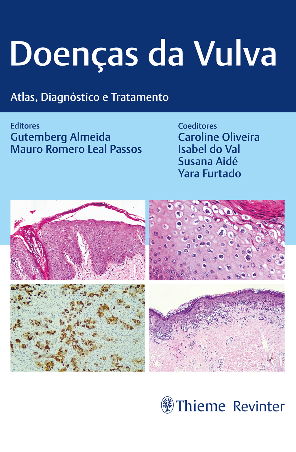 Doenças da Vulva: Atlas, Diagnóstico e Tratamento 1st Edition