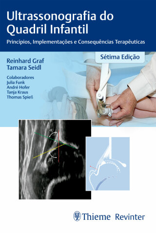 Cover image: Ultrassonografia do quadril infantil: princípios, implementação e consequências terapêuticas 7th edition 9786555722147