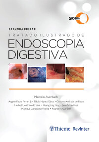 Imagen de portada: Tratado Ilustrado de Endoscopia Digestiva 2nd edition 9786555722376