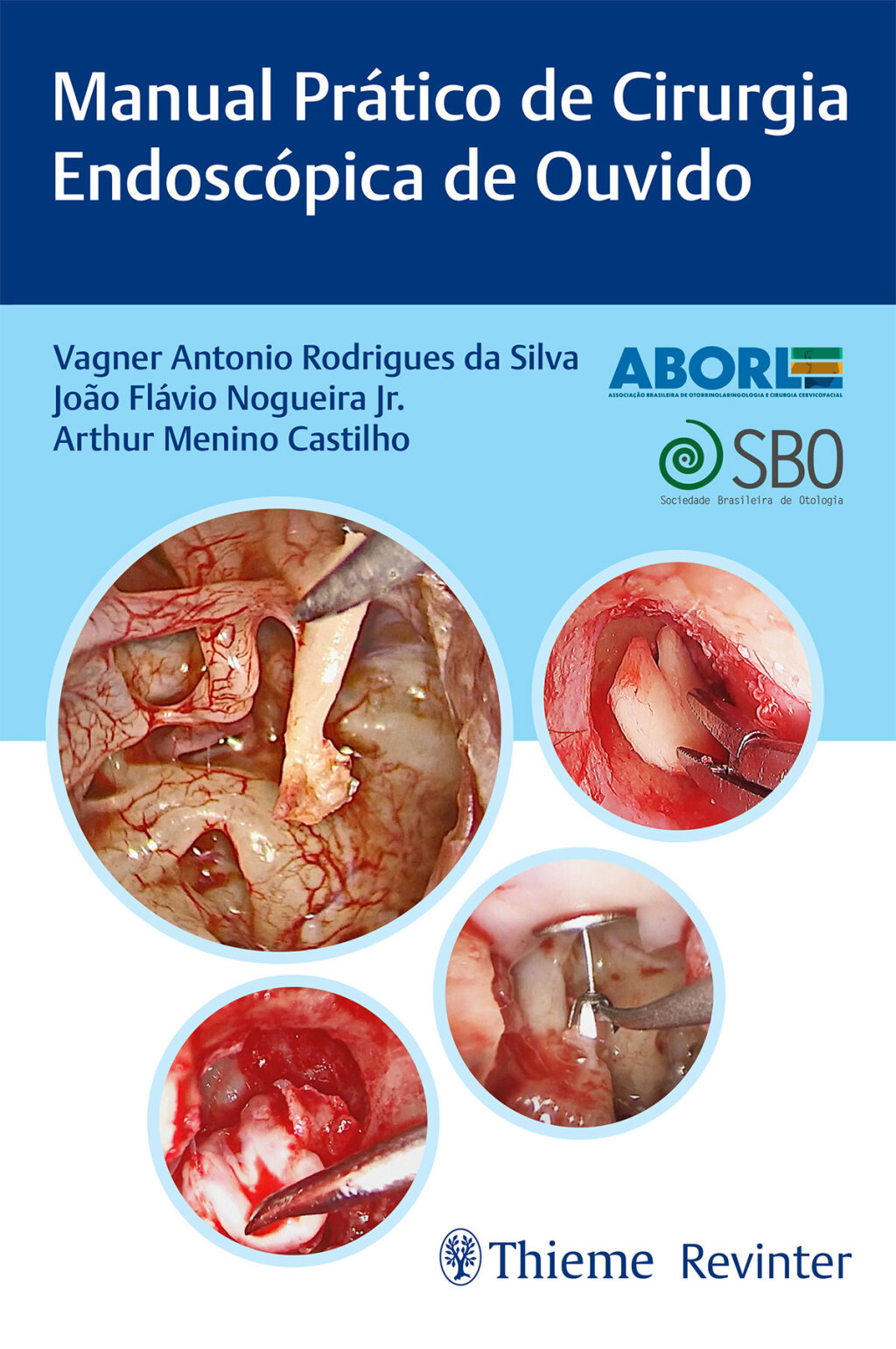 Manual Prático de Cirurgia Endoscópica de Ouvido 1st Edition