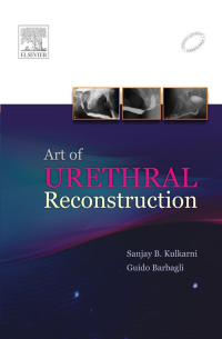 Cover image: Art of Urethral Reconstruction 9788131230541