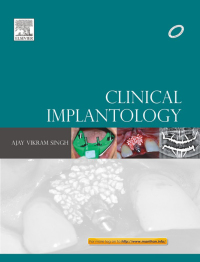 صورة الغلاف: Clinical Implantology 9788131233245