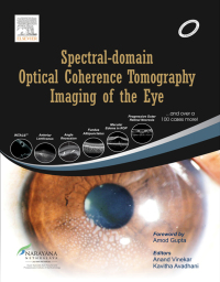 Cover image: Spectral-domain Optical Coherence Tomography Imaging of the Eye 9788131230527