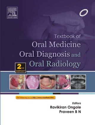 Immagine di copertina: Textbook of Oral Medicine, Oral Diagnosis and Oral Radiology 2nd edition 9788131230916