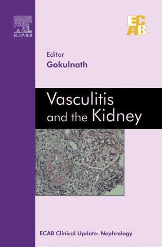 Immagine di copertina: Vasculitis and the Kidney - ECAB 9788131229323