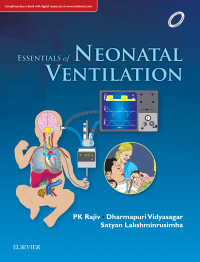 Cover image: Essentials of Neonatal Ventilation 1st edition 9788131249987