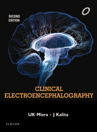 Cover image: Clinical Electroencephalography 2nd edition 9788131252956