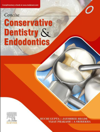 Cover image: Concise Conservative Dentistry and Endodontics 1st edition 9788131253434