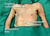 Cover image: Upper Limb - Anterior Shoulder, Pectoral Region, Breast and Brachial Plexus 1st edition 9788131258286