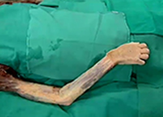Cover image: Upper Limb  - Flexor and Extensor Compartment of the Arm and Shoulder Joint 1st edition