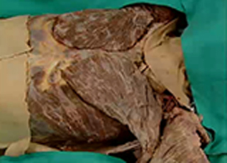Cover image: Thorax - Anterior Body Wall, Mediastinum and Heart 1st edition 9788131258330