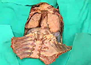 Immagine di copertina: Thorax - Lungs and Pleural Cavity 1st edition 9788131258354