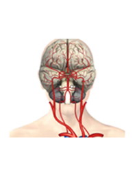 Cover image: Cerebral Vascular System 9788131258682