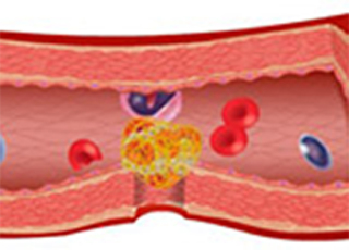 Cover image: Clotting Time (CT) 9788131258910