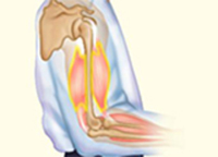 Immagine di copertina: Effect of Load on SMT (Free & After Load) 9788131258965