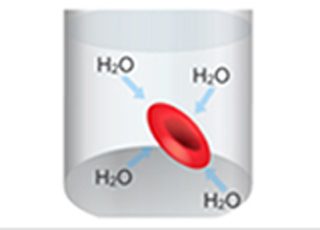 Cover image: Osmotic Fragility 9788131259108