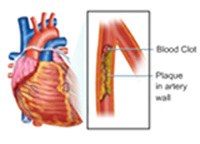 Cover image: Estimation of Blood Triglycerides 9788131259337