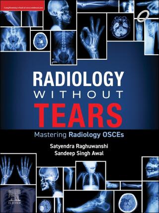 Cover image: Radiology Without Tears 9788131269398