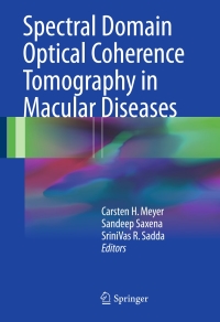 Omslagafbeelding: Spectral Domain Optical Coherence Tomography in Macular Diseases 9788132236085