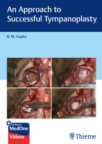 صورة الغلاف: An Approach to Successful Tympanoplasty 1st edition 9789395390934