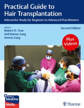 Cover image: Practical Guide to Hair Transplantation 2nd edition 9788197299032