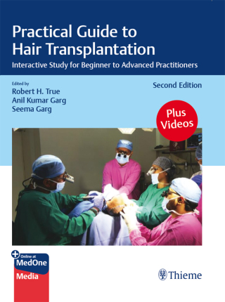 Cover image: Practical Guide to Hair Transplantation 2nd edition 9788197299032
