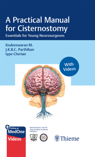 Cover image: A Practical Manual for Cisternostomy 1st edition 9788197475887