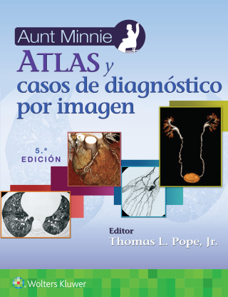 Cover image: Aunt Minnie. Atlas y casos de diagnóstico por imagen 5th edition 9788419663832