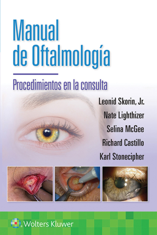 Cover image: Manual de oftalmología. Procedimientos en la consulta 9788410022706