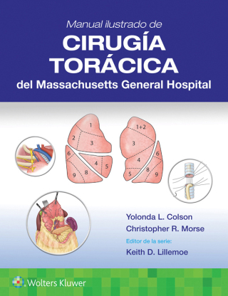 表紙画像: Manual ilustrado de Cirugía torácica del Massachusetts General Hospital 9788410870161