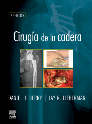 صورة الغلاف: Cirugía de la cadera 2nd edition 9788491139003