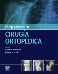 صورة الغلاف: Complicaciones en cirugía ortopédica 9788491135487