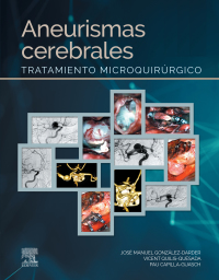 Cover image: Aneurismas cerebrales 9788491138853