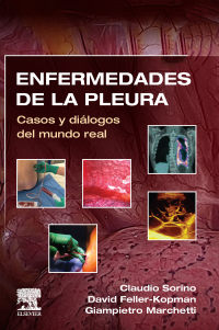 Immagine di copertina: Enfermedades de la pleura 9788413822037