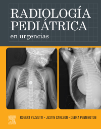 Cover image: Radiología pediátrica en urgencias 1st edition 9788413822945