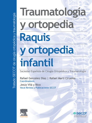 Immagine di copertina: Traumatología y ortopedia. Raquis y ortopedia infantil 1st edition 9788491131588
