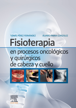 Cover image: Fisioterapia en procesos oncológicos y quirúrgicos de cabeza y cuello 1st edition 9788491138341
