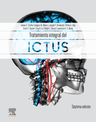Titelbild: Tratamiento integral del ictus 7th edition 9788413822754
