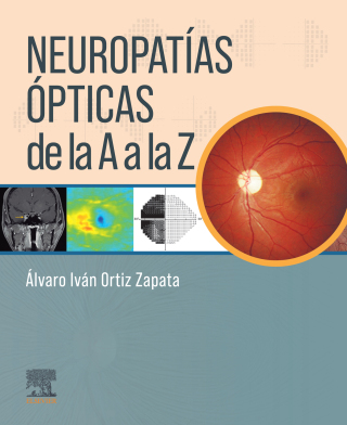 صورة الغلاف: Neuropatías ópticas de la A a la Z 1st edition 9788413822952