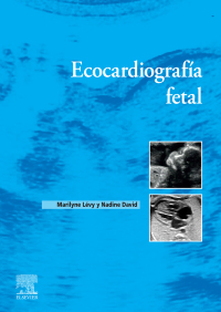 Cover image: Ecocardiografía fetal 1st edition 9788413825311