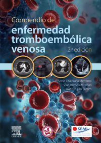 صورة الغلاف: Compendio de enfermedad tromboembólica venosa 2nd edition 9788413824277