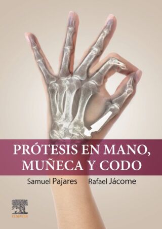 Cover image: Prótesis en mano, muñeca y codo 1st edition 9788413823690