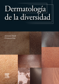 表紙画像: Dermatología de la diversidad 1st edition 9788413826103