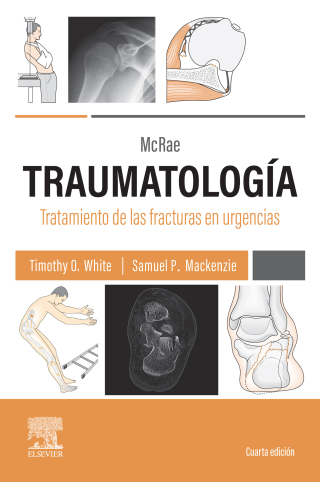 Cover image: McRae. Traumatología. Tratamiento de las fracturas en urgencias 4th edition 9788413826820