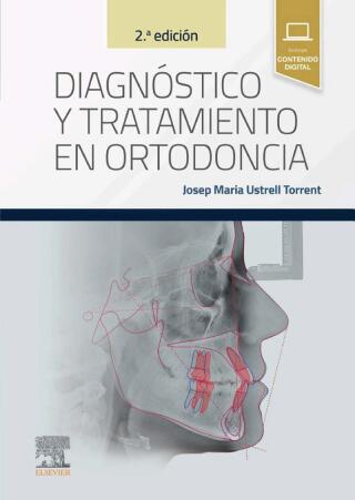 Cover image: Diagnóstico y tratamiento en ortodoncia 2nd edition 9788413825632