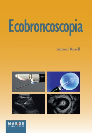 Cover image: Ecobroncoscopia 1st edition 9788415340270